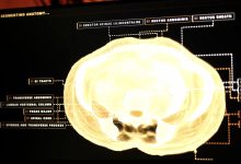 Midjourney, the AI image generator, is developing a full-body ultrasonic scanner